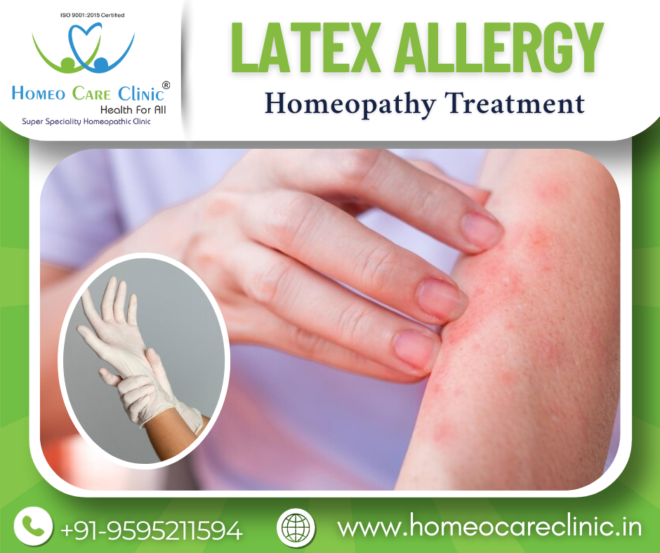 Latex Allergy – Natural Healing