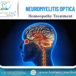optic nerve and spinal cord due to NMO
