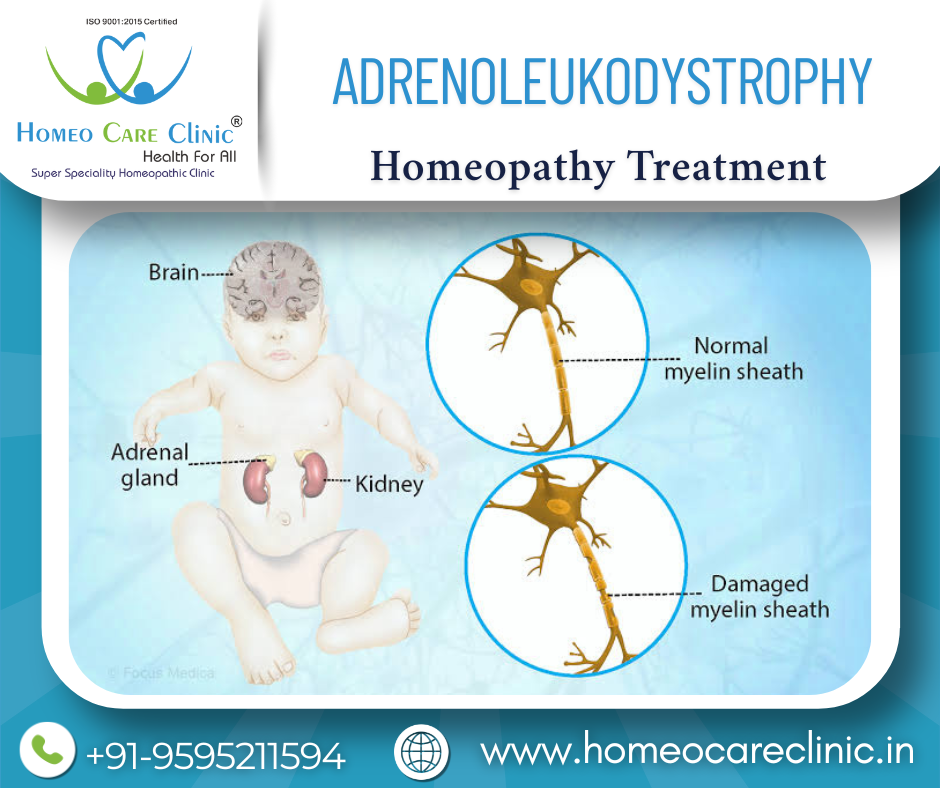 Homeopathy for Adrenoleukodystrophy