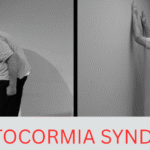 Camptocormia Syndrome