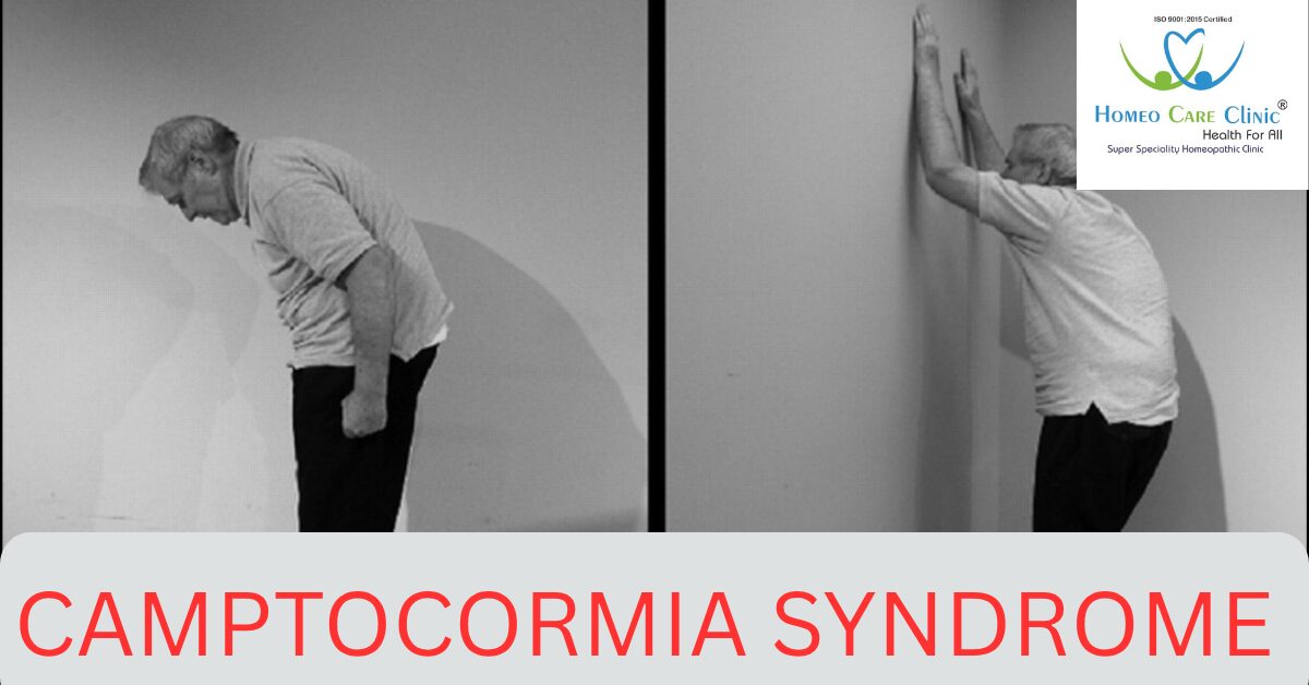 Camptocormia Syndrome