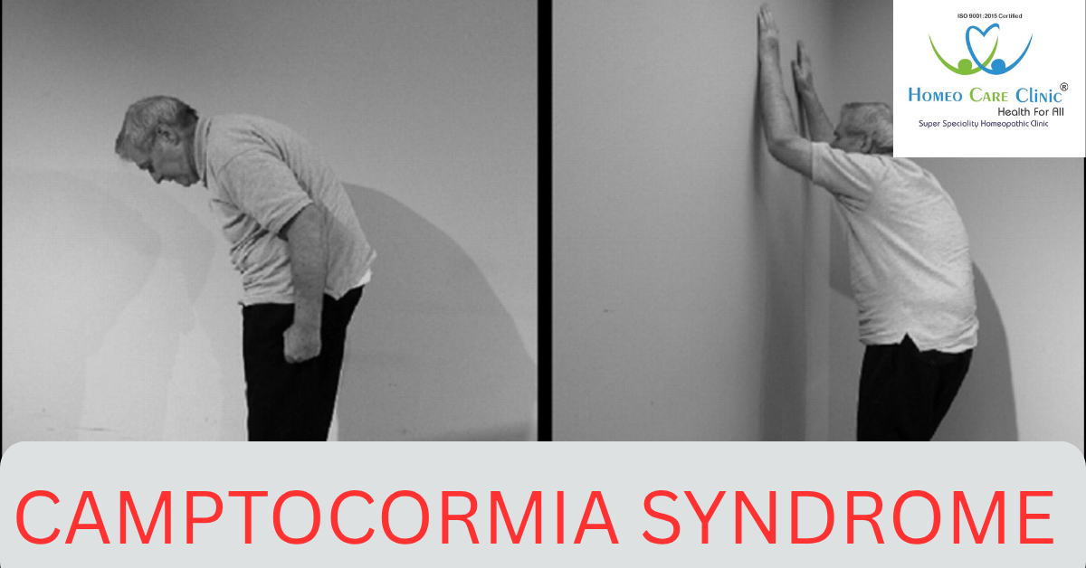 Camptocormia Syndrome
