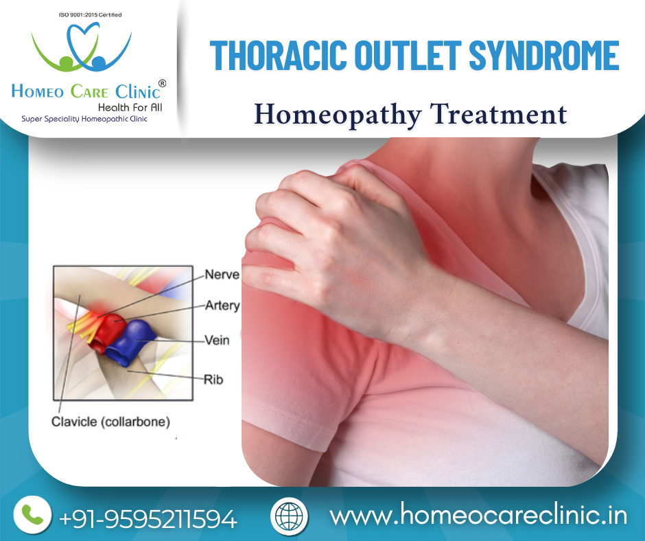 discomfort due to thoracic outlet syndrome
