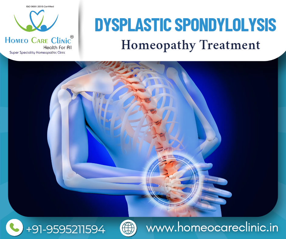 Dysplastic Spondylolysis