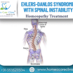 Ehlers-Danlos Syndrome and Spinal Instability