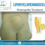 Lipomyelomeningocele