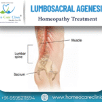 Lumbosacral Agenesis Treatment