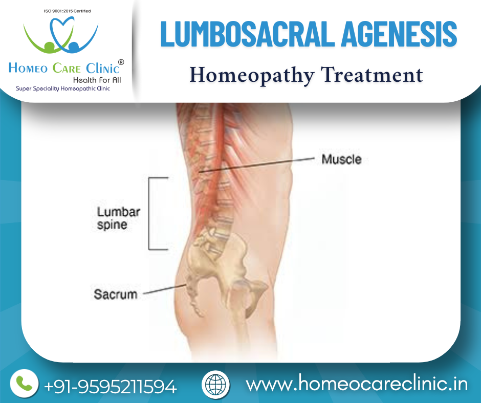 Lumbosacral Agenesis Treatment