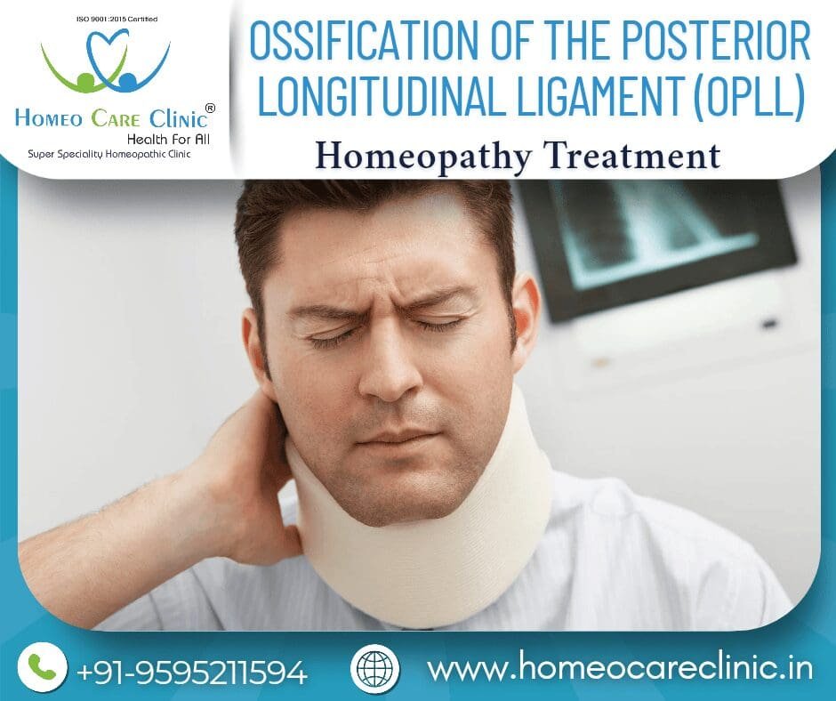 Ossification of the Posterior Longitudinal Ligament (OPLL)