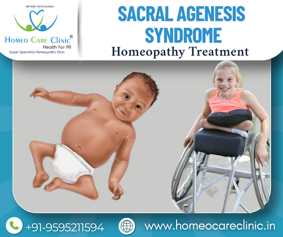 Sacral Agenesis Syndrome