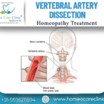 Vertebral Artery Dissection