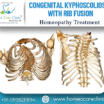 Homeopathic support for Congenital Kyphoscoliosis with Rib Fusion