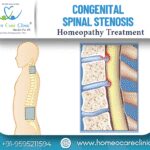 Homeopathic treatment for Congenital Spinal Stenosis
