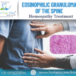 Homeopathic management for Spinal Eosinophilic Granuloma