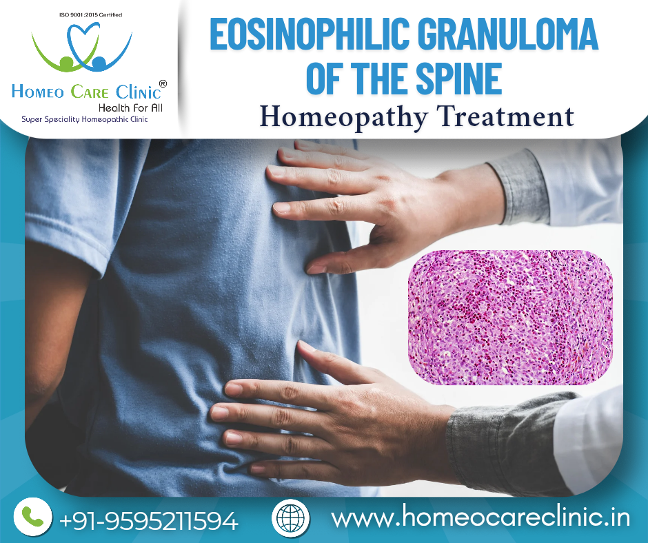 Homeopathic management for Spinal Eosinophilic Granuloma