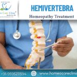 Homeopathic Medicine for Hemivertebra spinal deformity