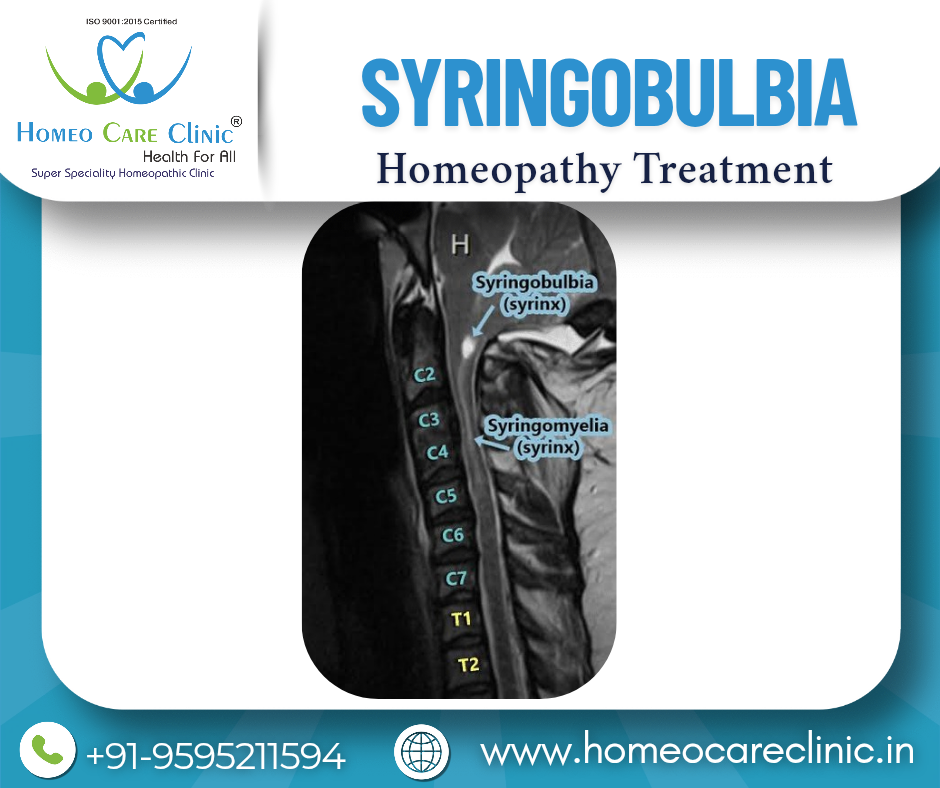 Syringobulbia Treatment