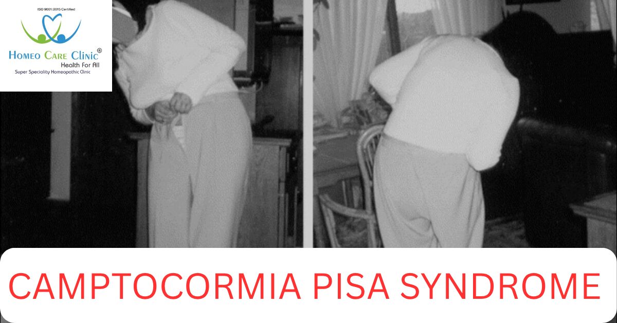 Camptocormia Syndrome