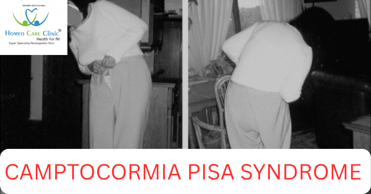 Camptocormia Syndrome