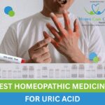 Best Homoeopathic Medicine for Uric Acid