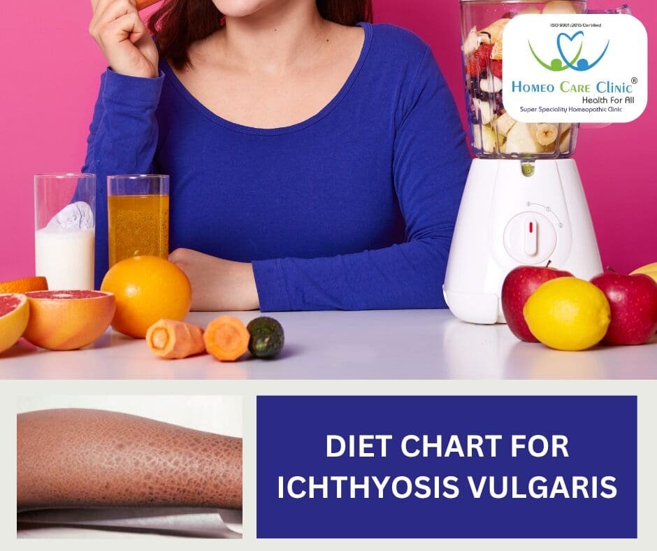 Ichthyosis Vulgaris Diet Chart for Skin Hydration and Repair Ichthyosis Vulgaris Diet Plan