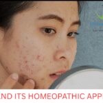 Acne types and treatment