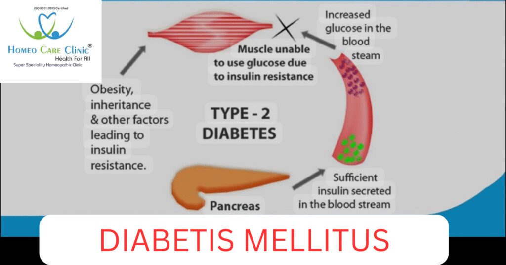 Diabetes Mellitus