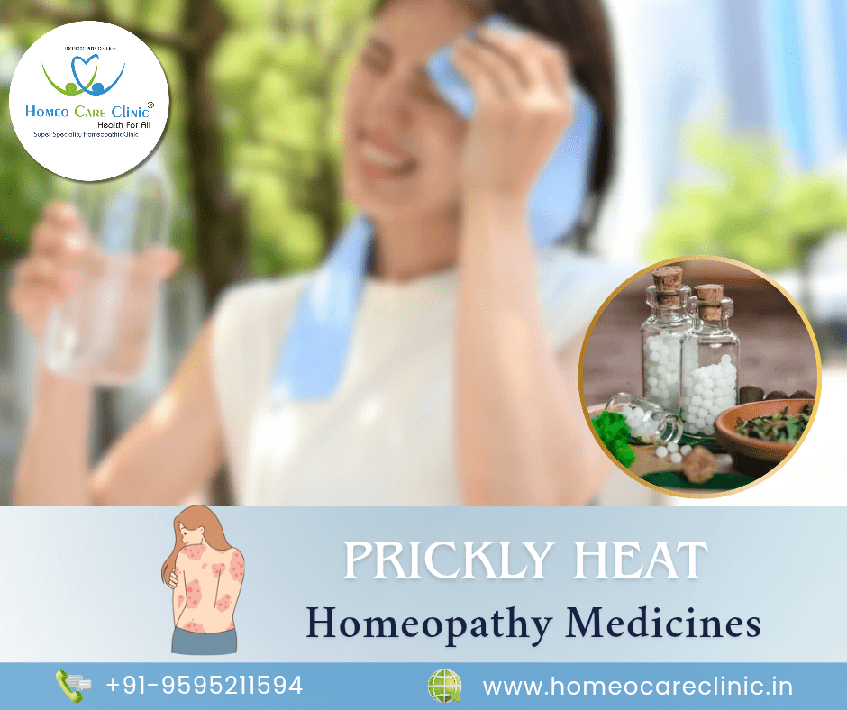 prickly heat medicine