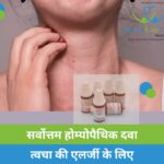 Twacha ki allergy