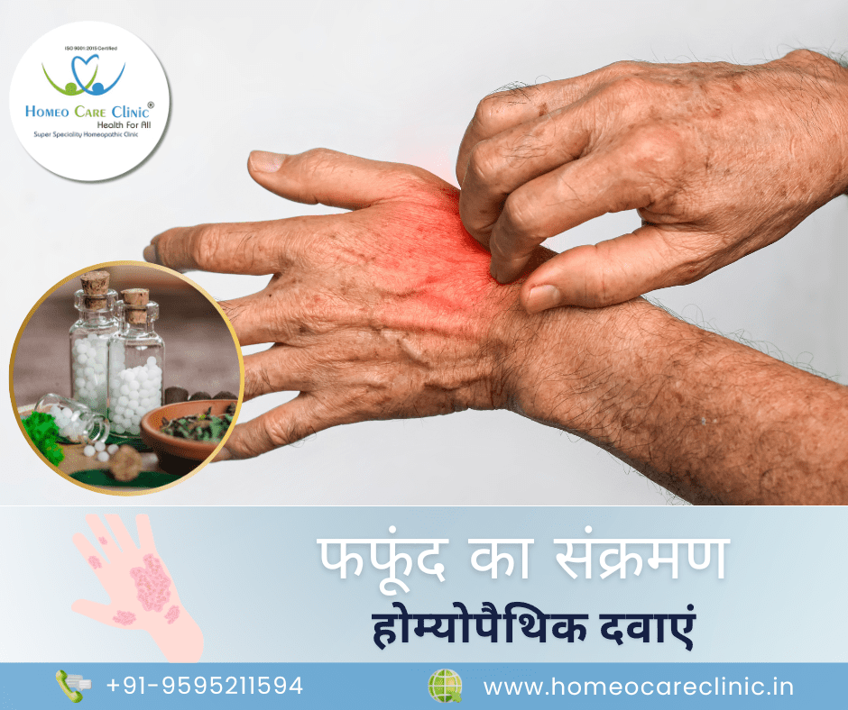 Medicines for Fungal Infection on Skin in Hindi