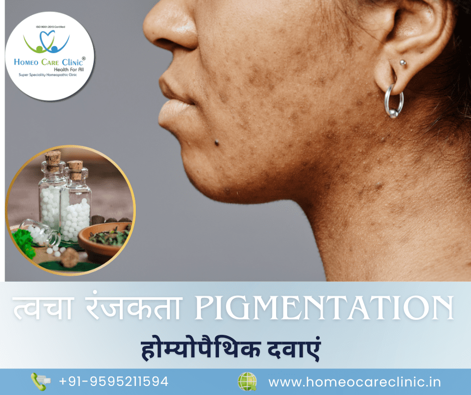 Medicines for Pigmentation in hindi