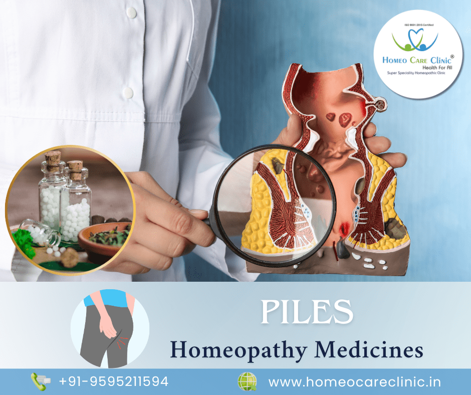 Piles Best 4 homeopathic medicine