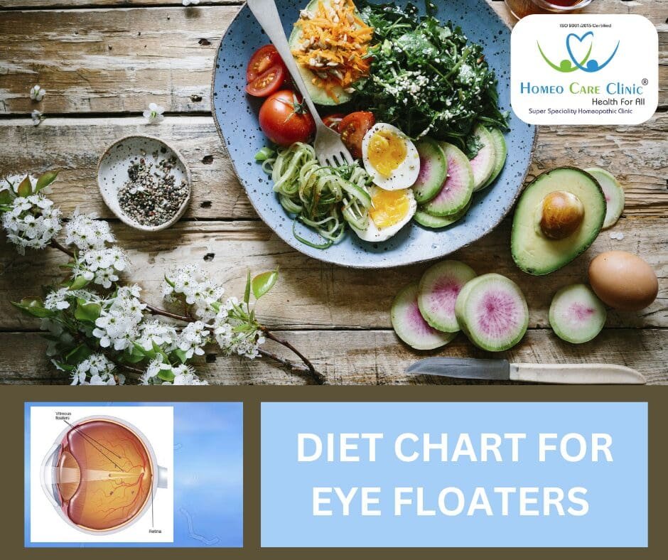 Nutritional Plan to Support Eye Floaters Eye floaters diet chart
