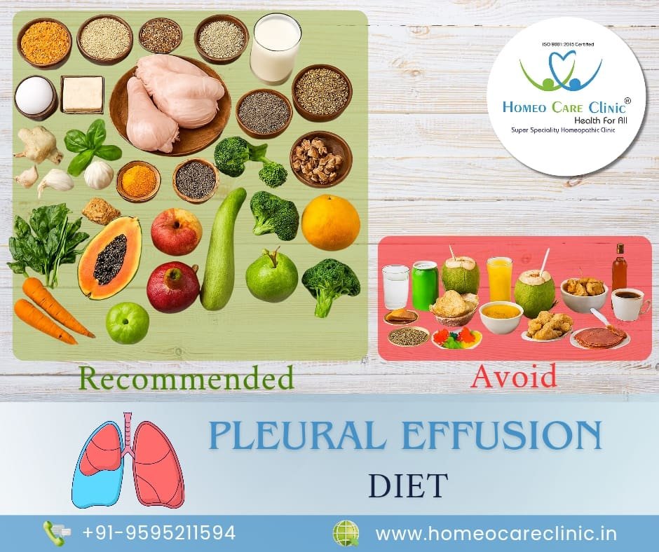 Diet for Pleural Effusion