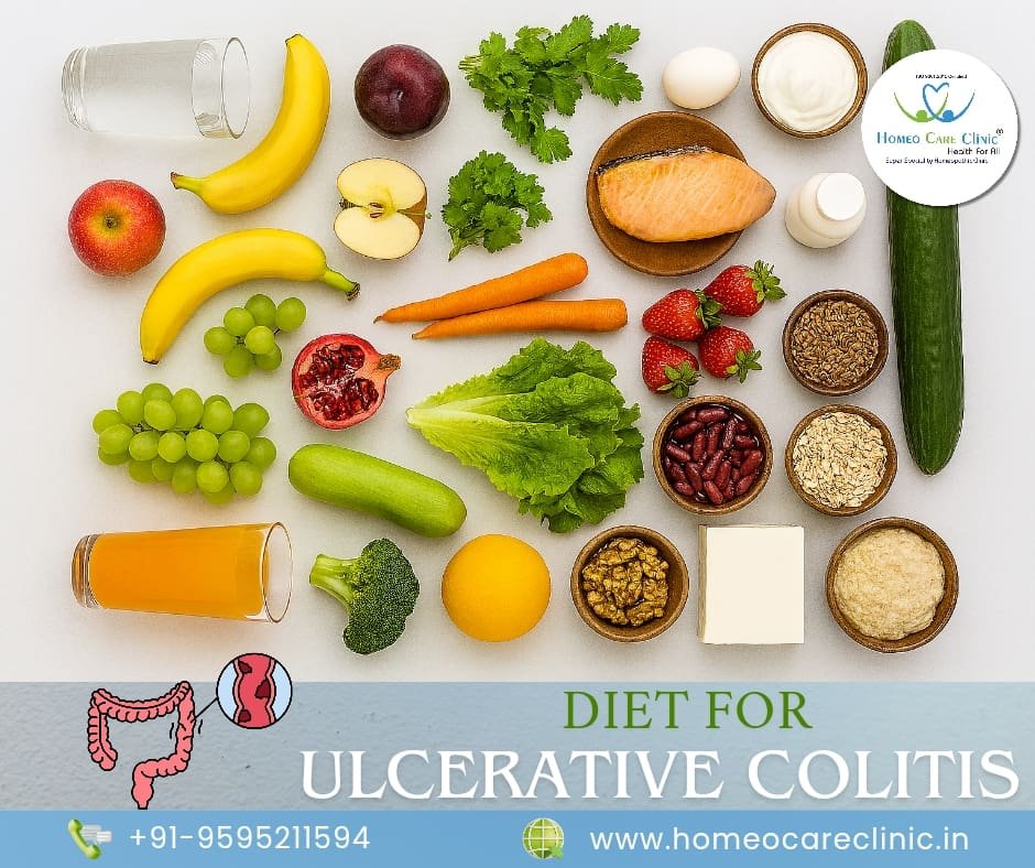 Ulcerative Colitis Diet Plan for Gut Health & Recovery Balanced ulcerative colitis diet meal