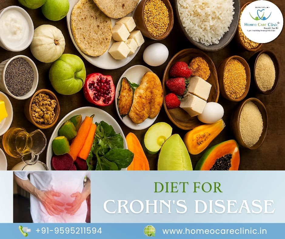 Diet for Crohn’s Disease