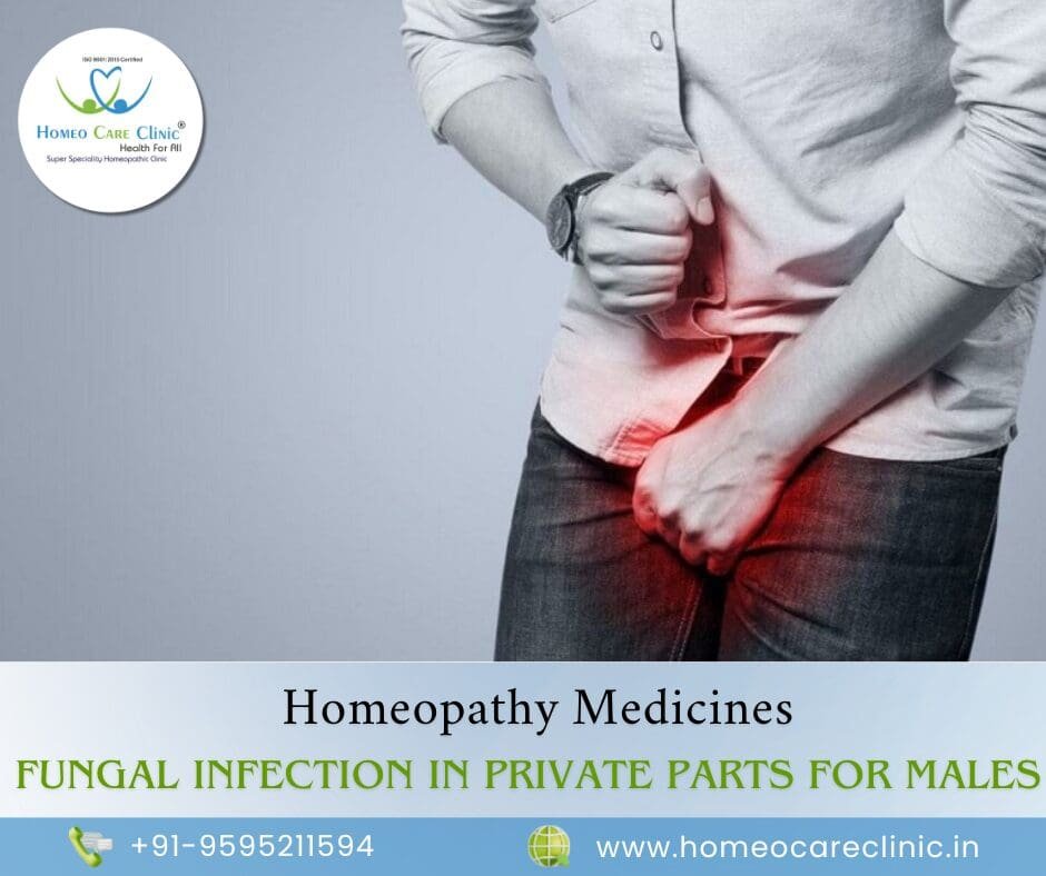 homeopathic remedies for fungal infection in male private parts