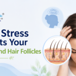 How Stress Affects Your Scalp and Hair Follicles