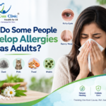 Adult-Onset Allergies: Causes, Symptoms & Treatment - Homeo Care Clinic